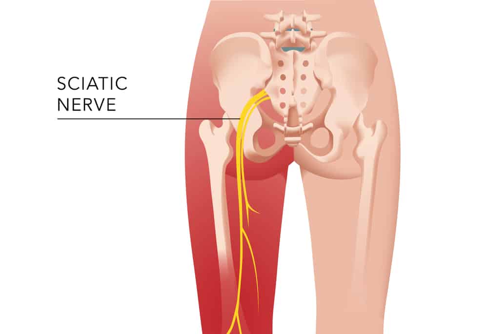 Sciatic Nerve 