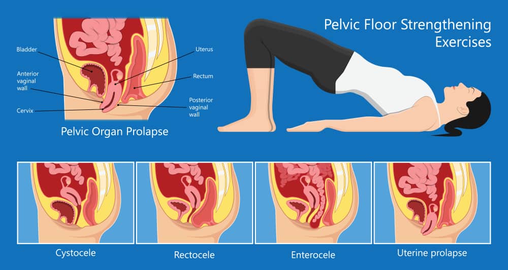 PELVIC FLOOR EXERCISES