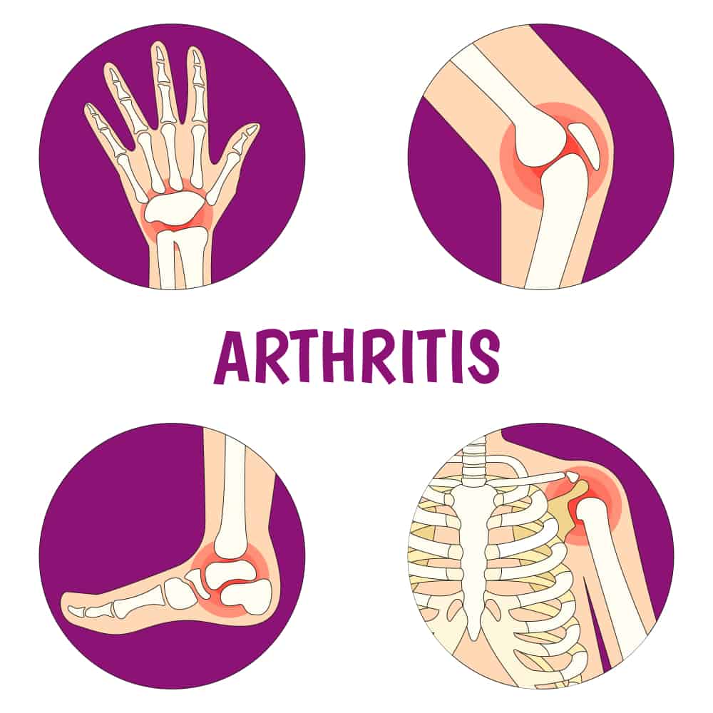 types of arthritis