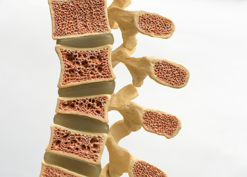 How to prevent osteoporosis in men