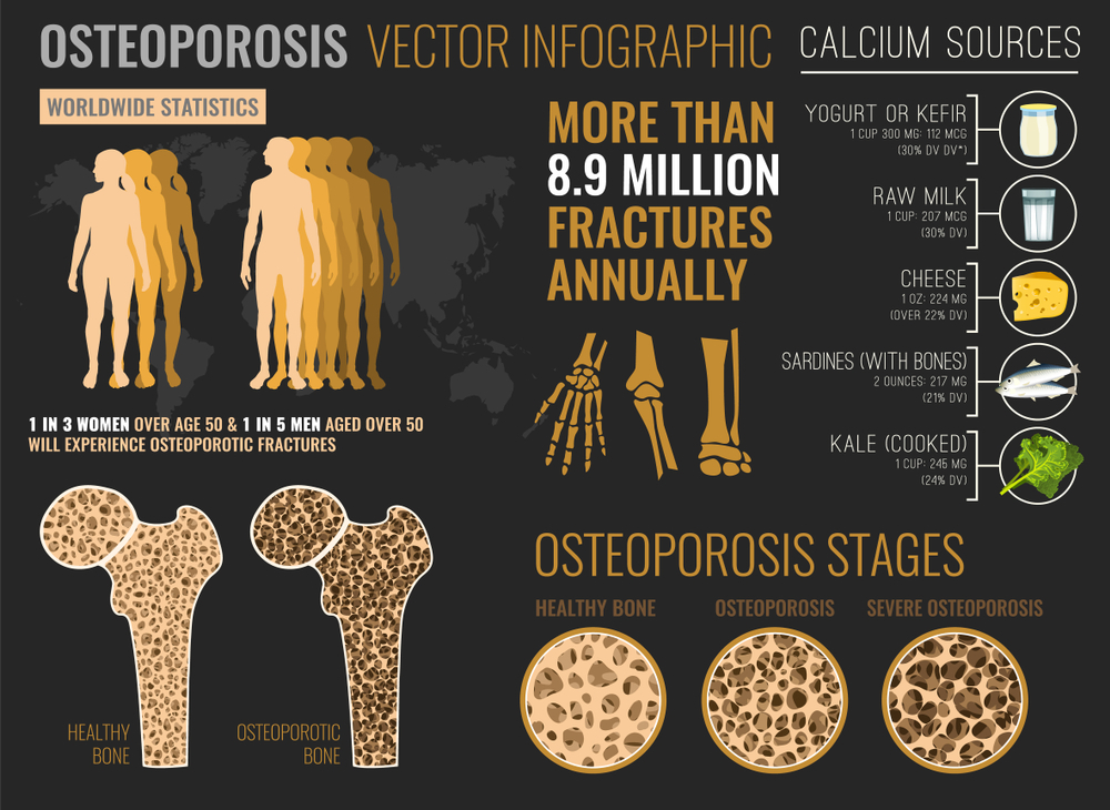 Facts about the Osteoporosis
